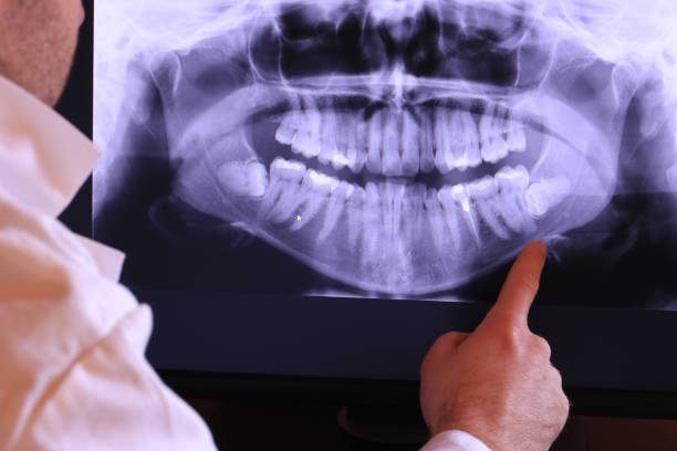 Best Weekend Emergency Dentist in Nixon, TX