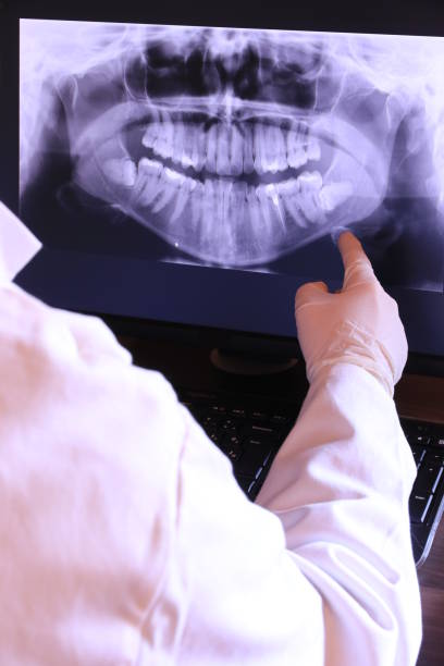 Best Emergency Dental Extractions in Nixon, TX